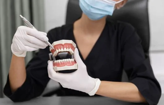 Bridge ou Implant Dentaire Les Bases à Connaître