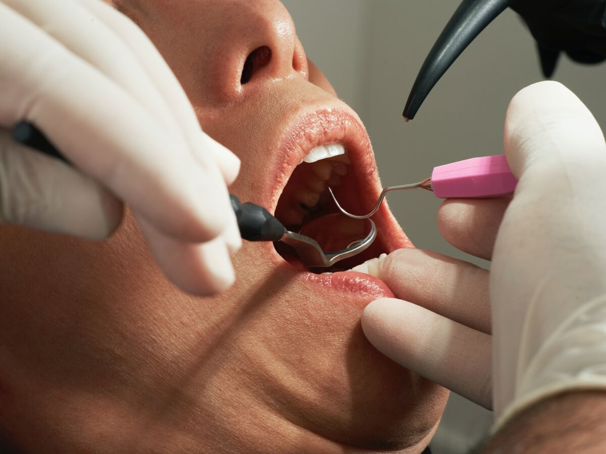 Infections Silencieuses Reconnaître une Infection Dentaire Sans Douleur 