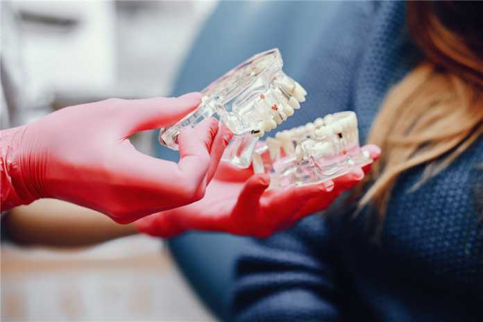 La Révolution des Prothèses Dentaires sur Implants