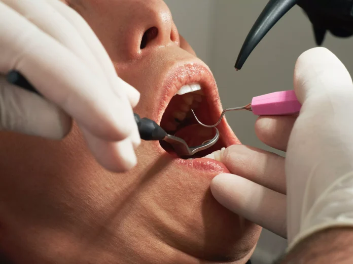 L'expérience Rennaise en Implantologie Dentaire