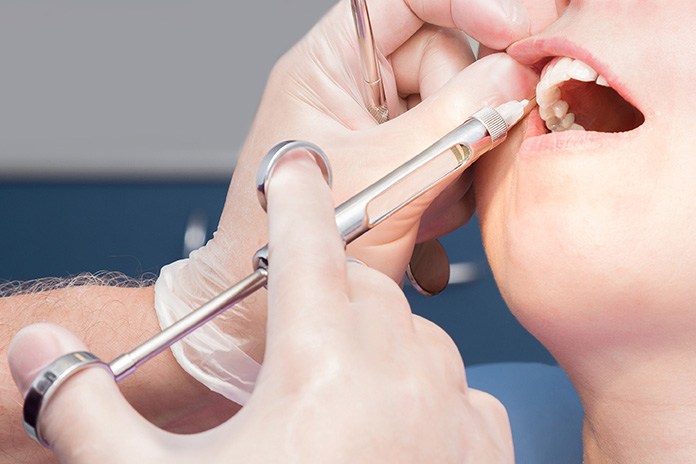 Précautions et soins post-détartrage  Comment prendre soin de vos dents