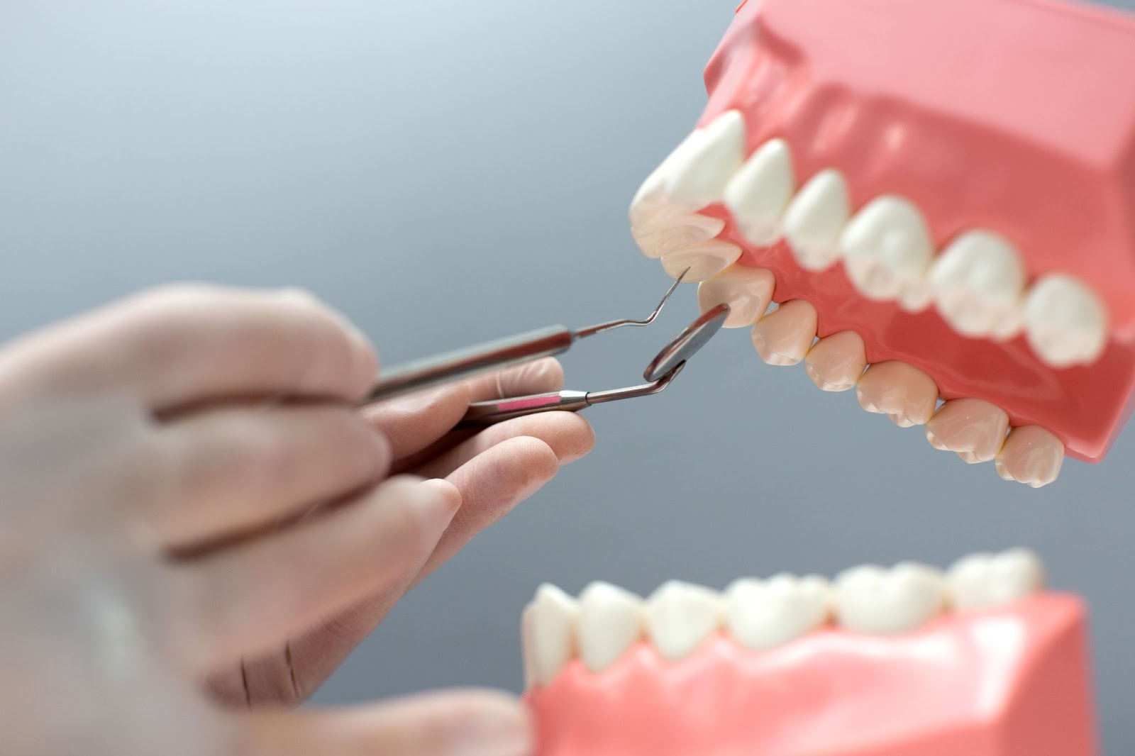 Prix moyen d’un implant dentaire à travers la France  Comparaisons Régionales